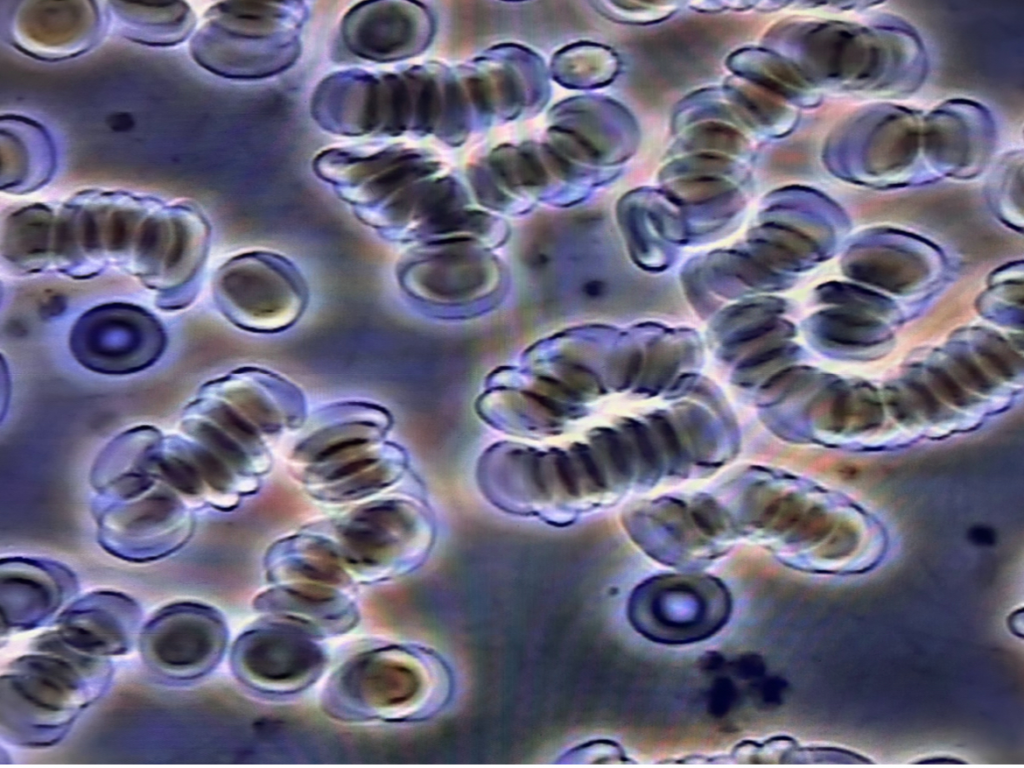 rouleaux blood jpg.webp