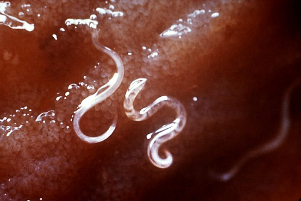 hookworms