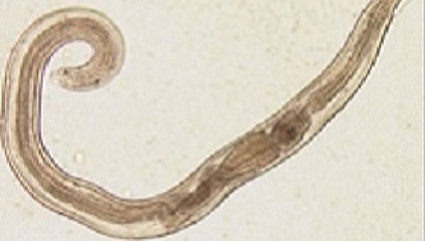 pinworm cdc
