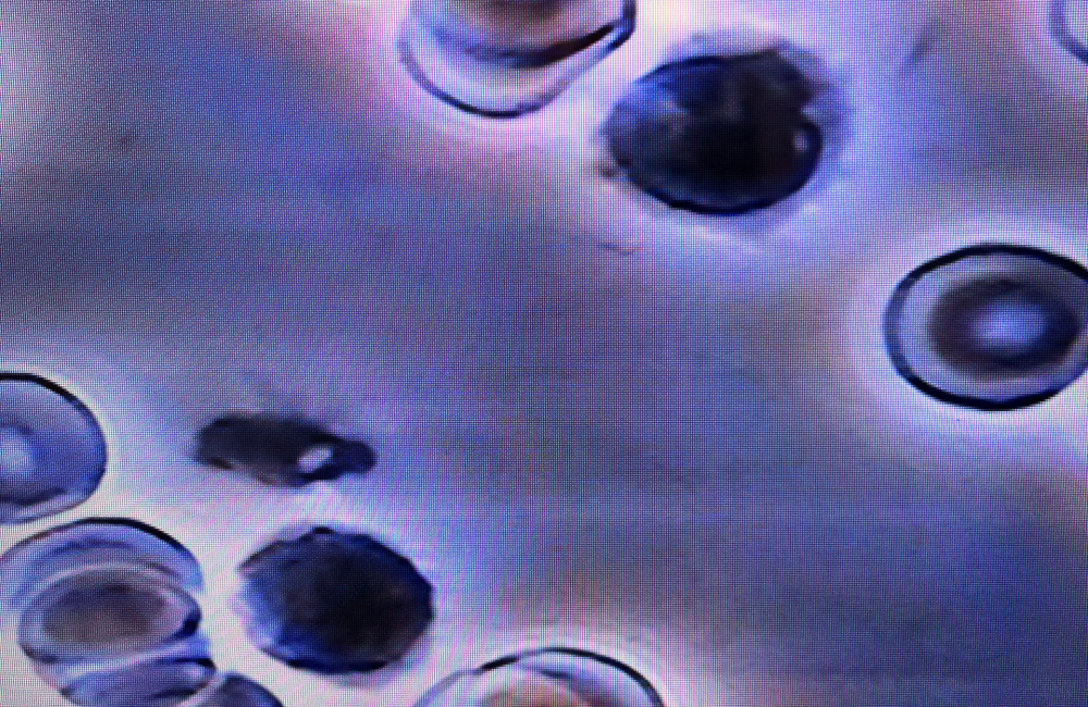 t cells .webp