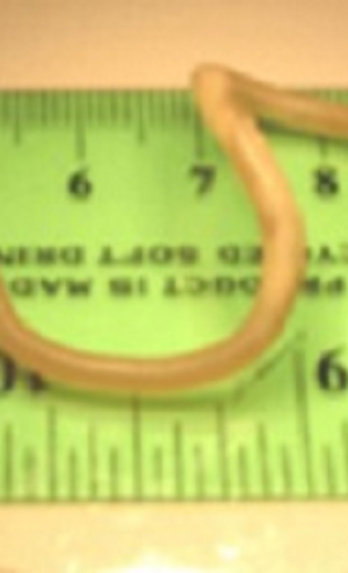 roundworm ascariasis